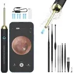 Ear Wax Removal - Ear Cleaner,Ear Camera 1080P with Lights - Wax Removal (Black)